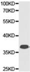 Major Histocompatibility Complex, Class II, DR Alpha antibody, TA322280, Origene, Western Blot image 