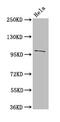 NPC Intracellular Cholesterol Transporter 1 antibody, CSB-PA890689LA01HU, Cusabio, Western Blot image 