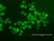 ERBB2 antibody, LS-C796704, Lifespan Biosciences, Immunofluorescence image 