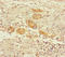 Oxoglutarate Dehydrogenase antibody, LS-C318557, Lifespan Biosciences, Immunohistochemistry paraffin image 