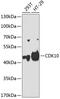 Cyclin-dependent kinase 10 antibody, GTX33084, GeneTex, Western Blot image 