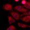Lactate Dehydrogenase A antibody, GTX50001, GeneTex, Immunofluorescence image 