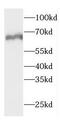 CTP Synthase 1 antibody, FNab02060, FineTest, Western Blot image 