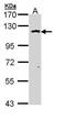 O-Linked N-Acetylglucosamine (GlcNAc) Transferase antibody, PA5-22092, Invitrogen Antibodies, Western Blot image 