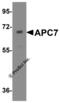 Anaphase Promoting Complex Subunit 7 antibody, 5731, ProSci Inc, Western Blot image 