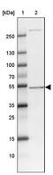 STEAP3 Metalloreductase antibody, PA5-62202, Invitrogen Antibodies, Western Blot image 