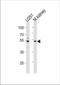 Glycoprotein-N-acetylgalactosamine 3-beta-galactosyltransferase 1 antibody, TA325148, Origene, Western Blot image 