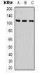SPT16 Homolog, Facilitates Chromatin Remodeling Subunit antibody, LS-C368860, Lifespan Biosciences, Western Blot image 