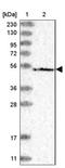 Solute Carrier Family 22 Member 16 antibody, NBP1-85410, Novus Biologicals, Western Blot image 