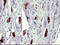 Ataxin 7 Like 1 antibody, M12910, Boster Biological Technology, Immunohistochemistry paraffin image 