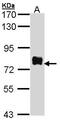 ATK antibody, GTX101346, GeneTex, Western Blot image 