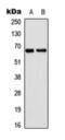 Epsin 2 antibody, orb393044, Biorbyt, Western Blot image 