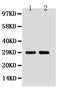 SSX Family Member 2B antibody, PA1235, Boster Biological Technology, Western Blot image 