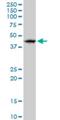 Ring Finger Protein 32 antibody, H00140545-D01P, Novus Biologicals, Western Blot image 
