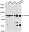 ADAM Metallopeptidase With Thrombospondin Type 1 Motif 4 antibody, A2525, ABclonal Technology, Western Blot image 