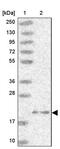 ADP-ribosylation factor-like protein 10B antibody, PA5-61127, Invitrogen Antibodies, Western Blot image 