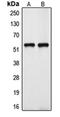 Cytochrome P450 Family 39 Subfamily A Member 1 antibody, orb215169, Biorbyt, Western Blot image 