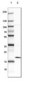 ADP Ribosylation Factor Like GTPase 2 Binding Protein antibody, NBP2-30477, Novus Biologicals, Western Blot image 