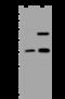 ATPase H+ Transporting V1 Subunit D antibody, 200459-T44, Sino Biological, Western Blot image 