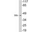 Indian Hedgehog Signaling Molecule antibody, LS-C199898, Lifespan Biosciences, Western Blot image 