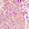 Extra Spindle Pole Bodies Like 1, Separase antibody, LS-C358749, Lifespan Biosciences, Immunohistochemistry paraffin image 
