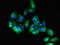Carcinoembryonic Antigen Related Cell Adhesion Molecule 6 antibody, LS-C677485, Lifespan Biosciences, Immunofluorescence image 