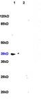 C-X-C Motif Chemokine Receptor 4 antibody, orb10305, Biorbyt, Western Blot image 