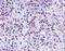 C-C Motif Chemokine Receptor 7 antibody, TA340538, Origene, Immunohistochemistry paraffin image 
