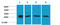 Heat Shock Protein Family B (Small) Member 1 antibody, STJ97373, St John