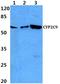 Cytochrome P450 Family 2 Subfamily C Member 9 antibody, A00465, Boster Biological Technology, Western Blot image 