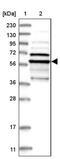 Tubulin Epsilon 1 antibody, PA5-56917, Invitrogen Antibodies, Western Blot image 