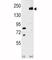 Low-density lipoprotein receptor-related protein 6 antibody, F49462-0.4ML, NSJ Bioreagents, Western Blot image 