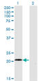 Ccn5 antibody, LS-B6392, Lifespan Biosciences, Western Blot image 