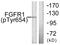 Fibroblast Growth Factor Receptor 1 antibody, LS-C198957, Lifespan Biosciences, Western Blot image 