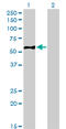 Eukaryotic translation initiation factor 5 antibody, LS-C133165, Lifespan Biosciences, Western Blot image 