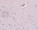 Zinc Finger Protein 536 antibody, NBP1-77092, Novus Biologicals, Immunohistochemistry frozen image 