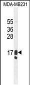 Prolactin Induced Protein antibody, PA5-35034, Invitrogen Antibodies, Western Blot image 