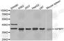 Insulin Like Growth Factor Binding Protein 7 antibody, A2982, ABclonal Technology, Western Blot image 