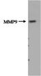 Matrix Metallopeptidase 9 antibody, NBP2-50515, Novus Biologicals, Western Blot image 