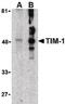 HAVcr-1 antibody, LS-B2103, Lifespan Biosciences, Western Blot image 