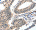 Caspase 3 antibody, A3164, ABclonal Technology, Immunohistochemistry paraffin image 