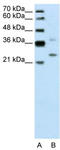 DCN1-like protein 1 antibody, TA344174, Origene, Western Blot image 