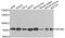 Zinc Finger Protein 408 antibody, A8512, ABclonal Technology, Western Blot image 