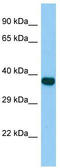 Zinc Finger Protein 367 antibody, TA342507, Origene, Western Blot image 
