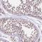 Chromosome 4 Open Reading Frame 47 antibody, HPA043662, Atlas Antibodies, Immunohistochemistry paraffin image 