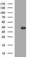 Fatty Acid 2-Hydroxylase antibody, CF506818, Origene, Western Blot image 