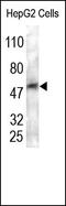 Carboxyl Ester Lipase antibody, 251942, Abbiotec, Western Blot image 