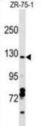 VPS50 Subunit Of EARP/GARPII Complex antibody, abx029584, Abbexa, Western Blot image 