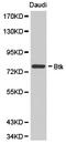Bruton Tyrosine Kinase antibody, LS-C192707, Lifespan Biosciences, Western Blot image 