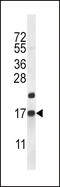 Cocaine- and amphetamine-regulated transcript protein antibody, 56-513, ProSci, Western Blot image 
